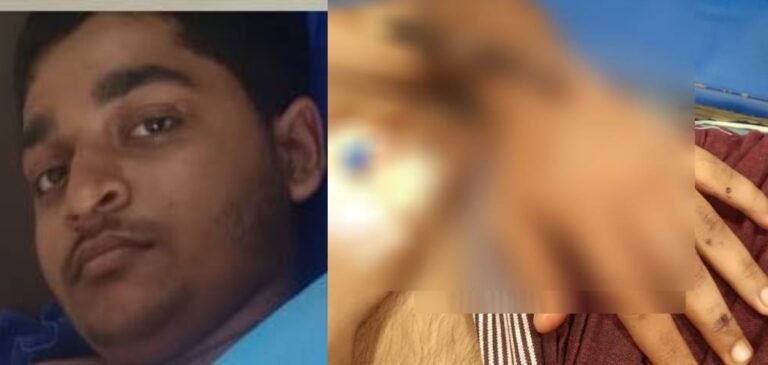 zkTU5GGVlnthuJi1ZpMQRwqmpGWBX6bk6ntTMbQx